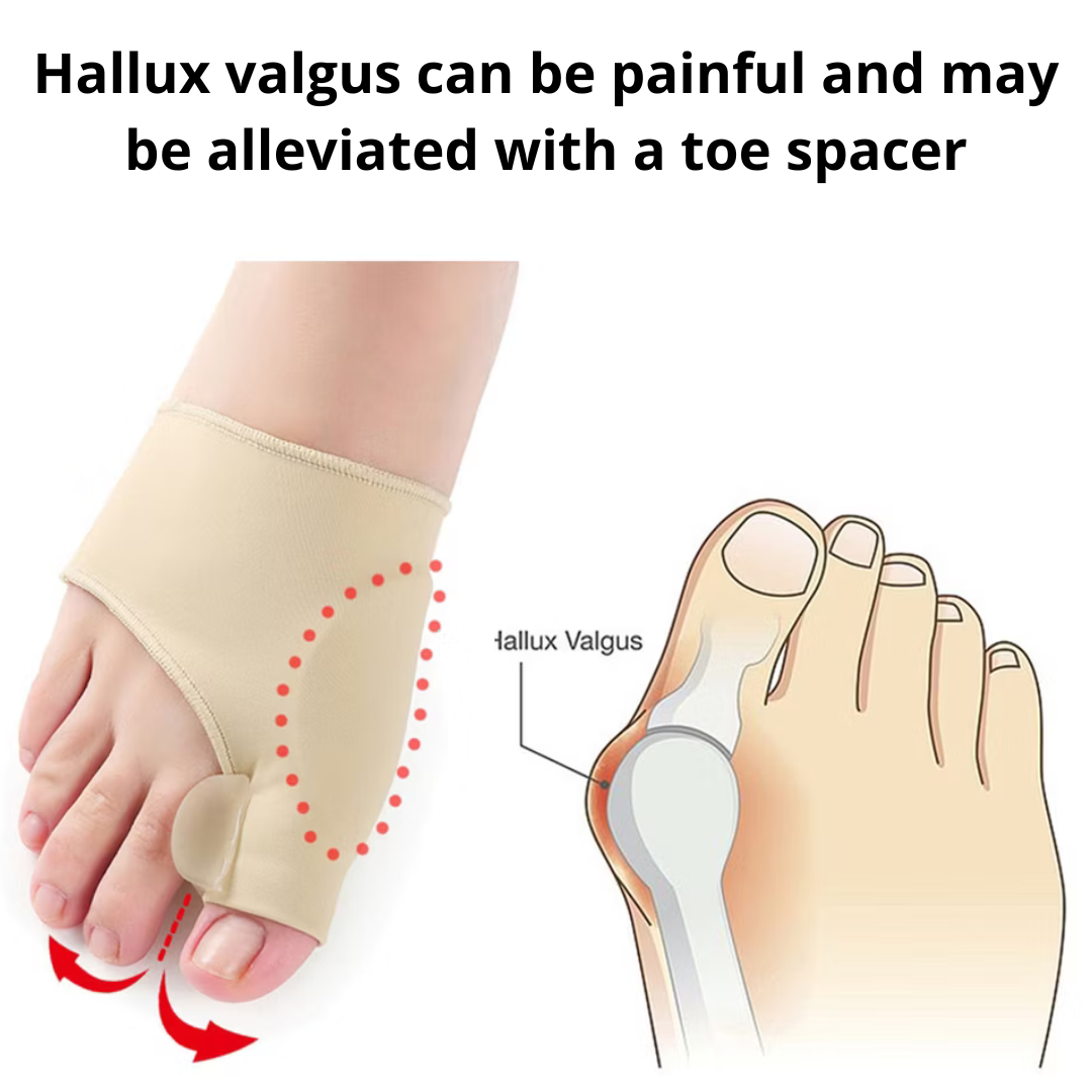 Hallux Valgus Support (2 Pieces)